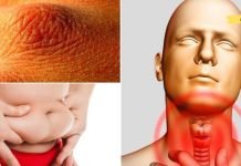 არასდროს უგულებელყოთ ეს მაფრთხილებელი ნიშნები! დროულად აღმოფხვერით ფარისებრი ჯირკვლის პრობლემები!