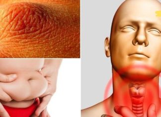 არასდროს უგულებელყოთ ეს მაფრთხილებელი ნიშნები! დროულად აღმოფხვერით ფარისებრი ჯირკვლის პრობლემები!