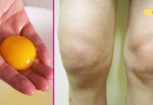 გამოიყენეთ მარილი და კვერცხის გული მუხლის ტკივილის სრულად აღმოსაფხვრელად და სახსრების „აღდგენისთვის“. დადასტურებული მეთოდი!