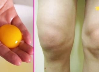 გამოიყენეთ მარილი და კვერცხის გული მუხლის ტკივილის სრულად აღმოსაფხვრელად და სახსრების „აღდგენისთვის“. დადასტურებული მეთოდი!