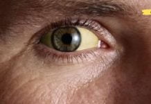 პროდუქტები, რომლებიც წმენდს და აძლიერებს ღვიძლს და თვალებს! საჭირო ინფორმაციაა..