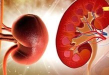 ნახეთ როგორ გავწმინდოთ თირკმელები და მოვაცილოთ ქვები ბუნებრივი გზით სახლში.. სასარგებლო ინფორმაცია!