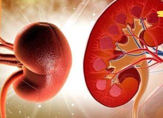 ნახეთ როგორ გავწმინდოთ თირკმელები და მოვაცილოთ ქვები ბუნებრივი გზით სახლში.. სასარგებლო ინფორმაცია!