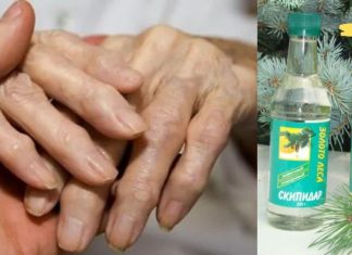 ეს ნამდვილად ხსა იქნება მტკივნეული სახსრებისთვის! საშუალება, რომელიც მართლა მუშაობს..