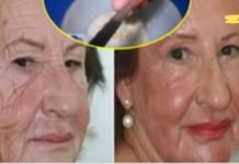 ბებიამ არავის დაუჯერა სანამ საკუთარ თავზე არ გამოსცადა ეს ხელნაკეთი შრატი, რომელიც 10 წლით აახალგაზრდავებს კანის ნებისმიერ ნაწილს.. თქვენც სცადეთ და ამაში თავად დარწმუნდით…