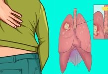 ფრთხილად: ფილტვის დაავადების ადრეული ნიშნები და სიმპტომები, რომლებიც არ უნდა უგულებელყოთ! ყურადღება მიაქციე შენს სხეულს!