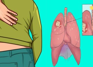 ფრთხილად: ფილტვის დაავადების ადრეული ნიშნები და სიმპტომები, რომლებიც არ უნდა უგულებელყოთ! ყურადღება მიაქციე შენს სხეულს!