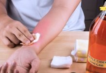 ეს ქალი კვირაში ორჯერ ისვამდა ხელზე ვაშლის ძმარს. 2 თვეში სახსრების ტკივილი თითქმის მთლიანად გაუქრა! აი როგორ აკეთებდა მას..