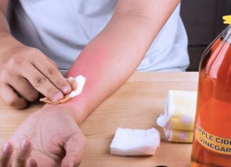 ეს ქალი კვირაში ორჯერ ისვამდა ხელზე ვაშლის ძმარს. 2 თვეში სახსრების ტკივილი თითქმის მთლიანად გაუქრა! აი როგორ აკეთებდა მას..