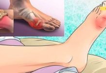 მოიშორეთ შარდმჟავა და სახსრების ტკივილი ამ მეთოდით! ამოიღოთ მარილები ორგანიზმიდან!