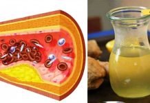 არ გამოიყენოთ კიდევ ერთი აბი მაღალი წნევისა და ცუდი ქოლესტერინის სამკურნალოდ. გამოიყენეთ ეს ბუნებრივი საშუალება! შესანიშნავი და ძალიან ეფექტური პროდუქტი!