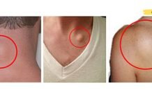 გამოიყენეთ ეს ბუნებრივი რეცეპტი ცხიმოვანი ქსოვილის (ლიპომების) მოსაცილებლად 8 დღის განმავლობაში – დაადასტურა ათასობით ადამიანმა!