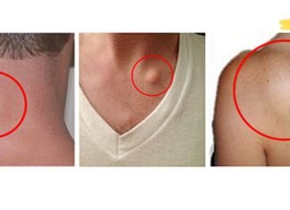 გამოიყენეთ ეს ბუნებრივი რეცეპტი ცხიმოვანი ქსოვილის (ლიპომების) მოსაცილებლად 8 დღის განმავლობაში – დაადასტურა ათასობით ადამიანმა!