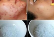 სახის ნიღაბი, რომელიც ჯადოსნურად აშორებს აკნეს, ნაწიბურებს და ნაოჭებს მეორე გამოყენების შემდეგ