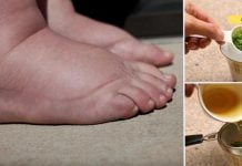 ეს ძლიერი ხელნაკეთი ჩაი რამდენიმე დღეში განკურნავს შეშუპებულ ფეხებს!