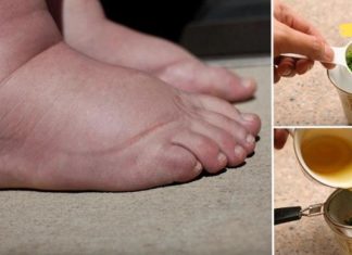 ეს ძლიერი ხელნაკეთი ჩაი რამდენიმე დღეში განკურნავს შეშუპებულ ფეხებს!