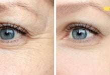 ეს სახის ნიღაბი მუშაობს როგორც ბოტოქსი. არ გადადო მისი გამოყენება!