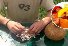 უმკურნალეთ გადიდებულ პროსტატას, დიაბეტს, ქოლესტერინსა და გასტრიტს ამ ბუნებრივი საშუალებით. საოცარი სარგებელი!