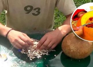 უმკურნალეთ გადიდებულ პროსტატას, დიაბეტს, ქოლესტერინსა და გასტრიტს ამ ბუნებრივი საშუალებით. საოცარი სარგებელი!