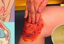 ხალხი გიჟდება ამ რეცეპტზე! კურნავს მუხლის, ძვლებისა და სახსრების ტკივილს!