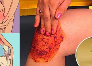 ხალხი გიჟდება ამ რეცეპტზე! კურნავს მუხლის, ძვლებისა და სახსრების ტკივილს!