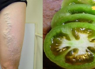 აი როგორ უნდა განვკურნოთ ვარიკოზული ვენები პომიდვრით! ეფექტური მეთოდია!