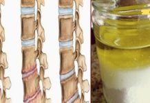 მარილი და ზეთი: სამკურნალო ნაზავი… მისი გამოყენების შემდეგ ტკივილს რამდენიმე წლის განმავლობაში ვეღარ იგრძნობთ!