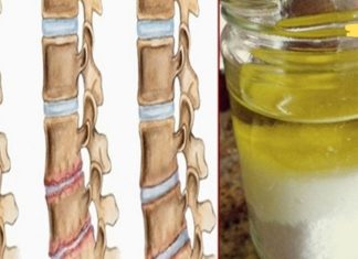 მარილი და ზეთი: სამკურნალო ნაზავი… მისი გამოყენების შემდეგ ტკივილს რამდენიმე წლის განმავლობაში ვეღარ იგრძნობთ!