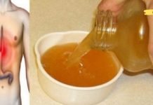 გაწუხებთ მჟავას რეფლუქსი? ეს ხელნაკეთი სასმელი თქვენს პრობლემას უმოკლეს დროში მოაგვარებს!