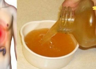 გაწუხებთ მჟავას რეფლუქსი? ეს ხელნაკეთი სასმელი თქვენს პრობლემას უმოკლეს დროში მოაგვარებს!