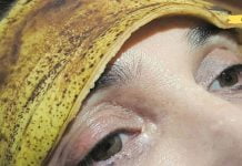 დაიდეთ ბანანის ქერქი შუბლზე. თქვენ უნდა სცადოთ ეს ხრიკი…ეს წარმოუდგენელია!