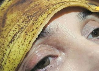 დაიდეთ ბანანის ქერქი შუბლზე. თქვენ უნდა სცადოთ ეს ხრიკი…ეს წარმოუდგენელია!