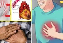 მოუსმინეთ თქვენს ორგანიზმს! ინფარქტამდე ექვსი თვით ადრე თქვენი ორგანიზმი გაფრთხილებთ! ყურადღებით გაეცანით და არ დააიგნოროთ ეს ნიშნები!