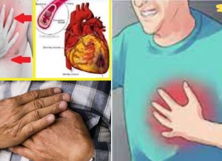 მოუსმინეთ თქვენს ორგანიზმს! ინფარქტამდე ექვსი თვით ადრე თქვენი ორგანიზმი გაფრთხილებთ! ყურადღებით გაეცანით და არ დააიგნოროთ ეს ნიშნები!