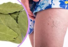 დაფნის ფოთოლის წყალობით თქვენ მოგეხსნებათ ვენების ვარიკოზი, მეხსიერების პრობლემები და თავის ტკივილი! აი როგორ უნდა გამოიყენოთ..