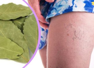 დაფნის ფოთოლის წყალობით თქვენ მოგეხსნებათ ვენების ვარიკოზი, მეხსიერების პრობლემები და თავის ტკივილი! აი როგორ უნდა გამოიყენოთ..