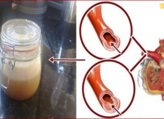 დაემშვიდობეთ მაღალ წნევას, ქოლესტერინს და ტრიგლიცერიდებს ამ ძლიერი სასმელით!