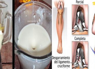 ამ ქალმა მუხლებისა და სახსრების ტკივილი ერთ დღეში მოიხსნა! გსურთ იცოდეთ როგორ?