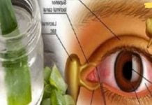 დაემშვიდობეთ სათვალეს და გაიუმჯობესეთ მხედველობა ამ საოცარი რეცეპტით! ამ წამლის შედეგი მართლაც გასაოცარია!