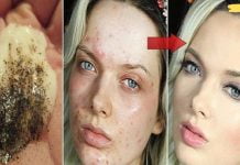 შეურიეთ ეს 2 ინგრედიენტი და ნახეთ რა დაემართება თქვენს კანს წუთებში! მეორე ნიღაბი საკუთარ თავზე “გამოვცადე” – მომეწონა ეფექტი!