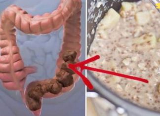 ეს ნარევი გაწმენდს თქვენს მსხვილ ნაწლავს! მე თვითონ ვცადე და შედეგი საოცარია!