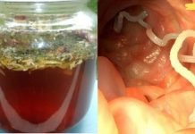 როგორ მოვიშოროთ ჭიები ეფექტურად: ვერცერთი აბი ვერ შეედრება ამ საშუალებას!