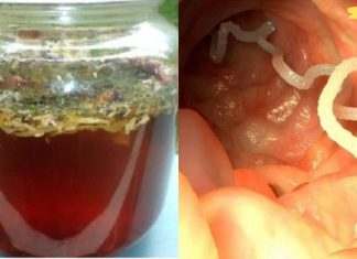 როგორ მოვიშოროთ ჭიები ეფექტურად: ვერცერთი აბი ვერ შეედრება ამ საშუალებას!