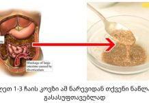 ნაწლავის ნაზი წმენდა: ჩვენ ვაშორებთ ყველაფერ მავნებელს, ვიკლებთ წონაში და ვხდებით ჯანმრთელები!