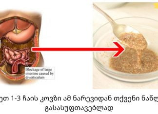 ნაწლავის ნაზი წმენდა: ჩვენ ვაშორებთ ყველაფერ მავნებელს, ვიკლებთ წონაში და ვხდებით ჯანმრთელები!