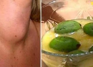 ექიმები ამას არასოდეს გეტყვიან: აი, როგორ მოვიშოროთ ფარისებრი ჯირკვლის პრობლემები მხოლოდ ერთი ინგრედიენტით!