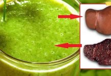 როგორ აღვადგინოთ ღვიძლი და გავწმინდოთ ის ტოქსინებისგან: რეკომენდაციები დიეტოლოგებისგან