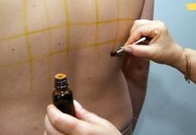 იოდის ბადე: მარტივი ხაზების სამკურნალო თვისებები. ძალიან სასარგებლოა!