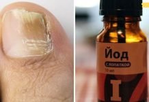 ეს არის ის, რაც დამეხმარა ამ საშინელი ფრჩხილის სოკოსგან თავის დაღწევაში! საჭიროა მხოლოდ 3 მკურნალობა!