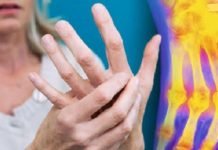 რატომ არ ვიცოდი ეს ადრე! ავადმყოფი სახსრების წამალი ყველა სახლშია. გააზიარეთ რეცეპტი!